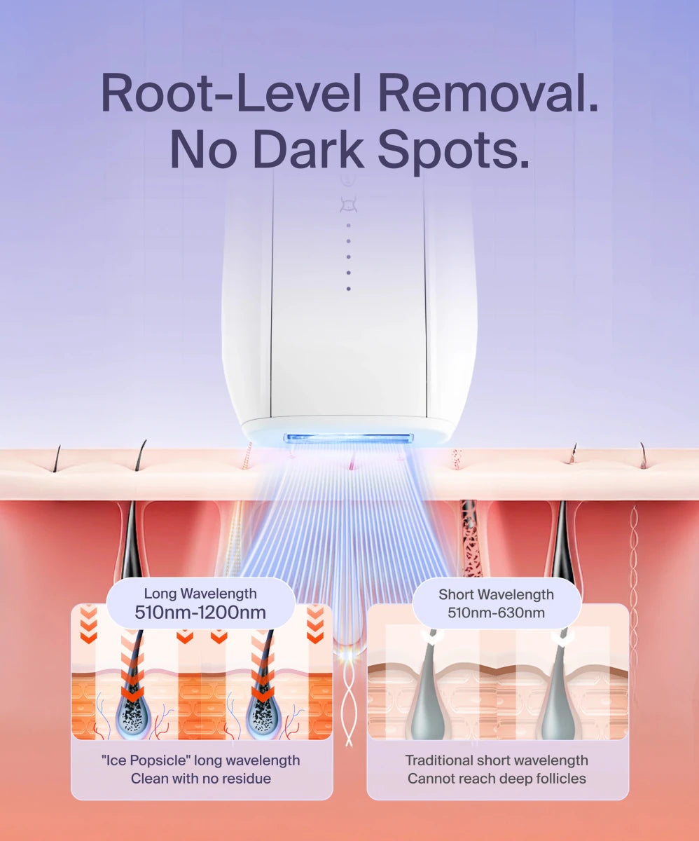 IPL Home Use Hair Removal Device — фото 6
